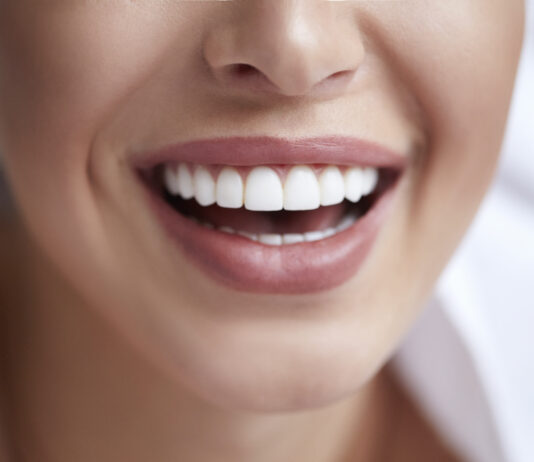 Wybielanie zębów – jak zrobić to skutecznie? Wybielanie zębów - metody