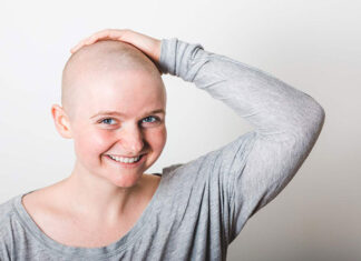 Przeszczep włosów dla kogo