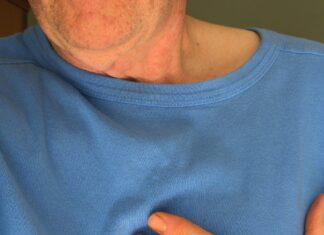 Metody zwalczania lipomastii